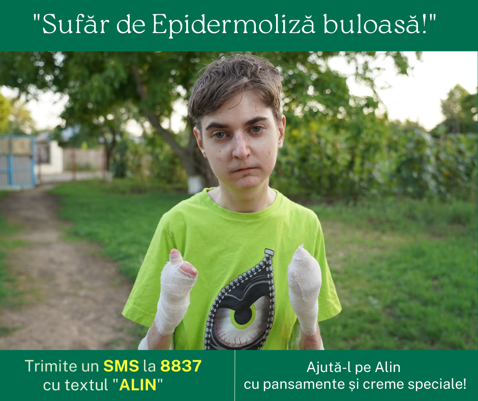 Donează 2 EURO prin SMS. Alin suferă de Epidermoliză buloasă!